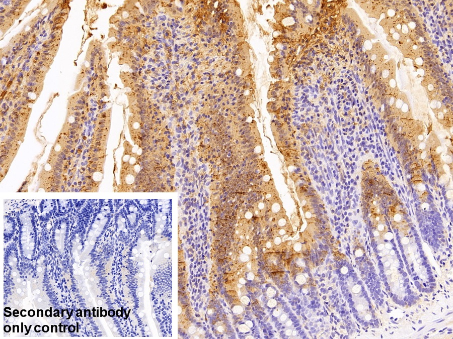 Polyclonal Antibody to Retinol Binding Protein 2, Cellular (RBP2)