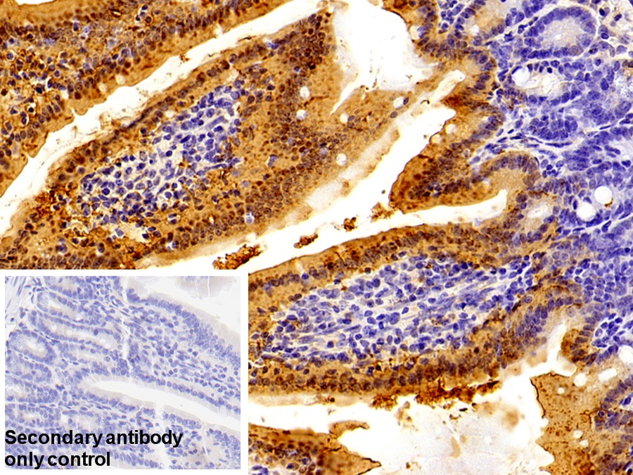 Polyclonal Antibody to Retinol Binding Protein 2, Cellular (RBP2)