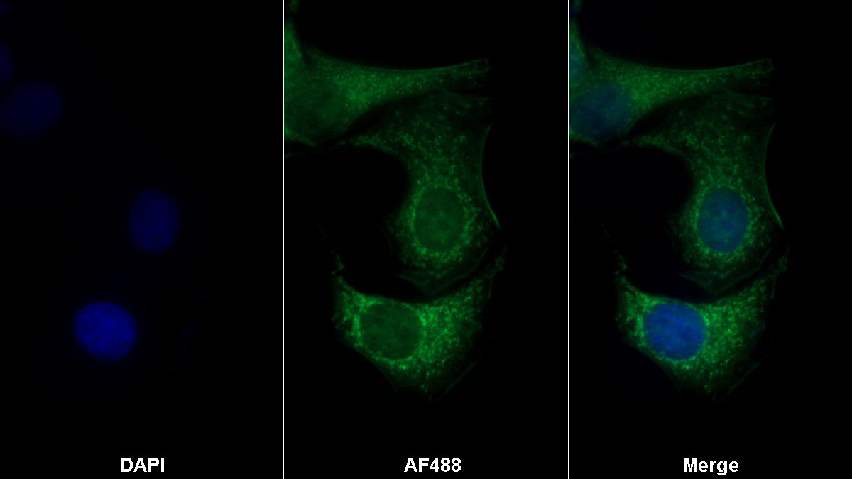 Polyclonal Antibody to Retinol Binding Protein 2, Cellular (RBP2)