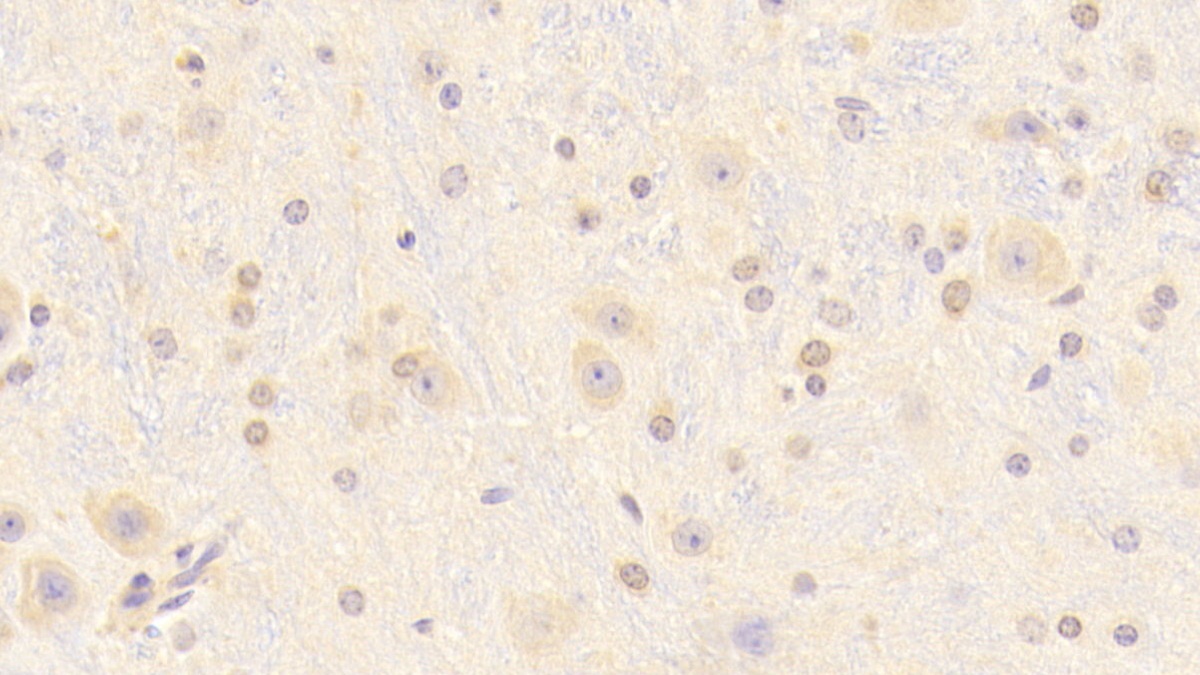 Polyclonal Antibody to Retinol Binding Protein 2, Cellular (RBP2)