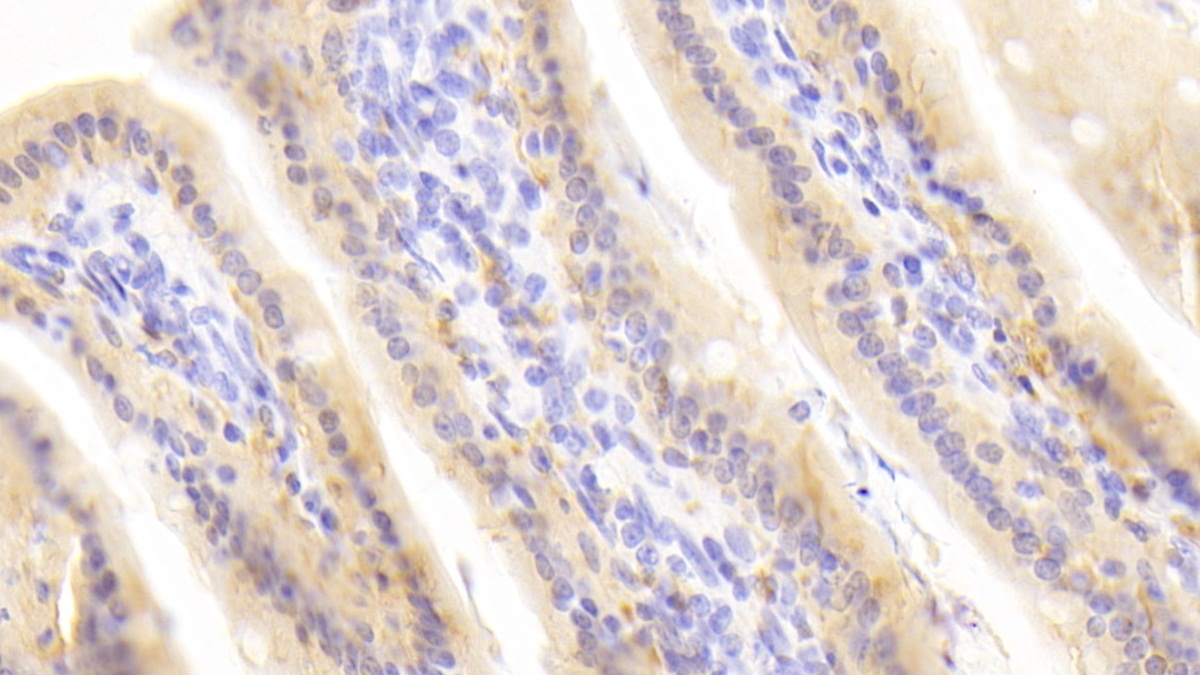 Polyclonal Antibody to Retinol Binding Protein 2, Cellular (RBP2)