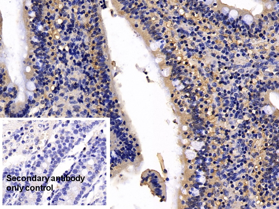 Polyclonal Antibody to Retinol Binding Protein 2, Cellular (RBP2)