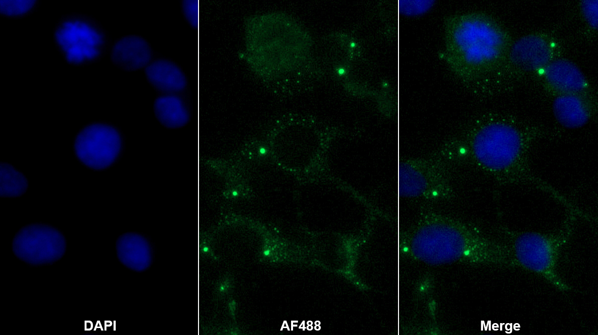 Polyclonal Antibody to Vasoactive Intestinal Peptide (VIP)