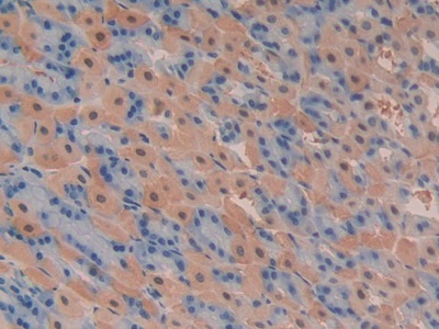 Polyclonal Antibody to Phosphoinositide-3-Kinase Class-2-Alpha Polypeptide (PIK3C2a)