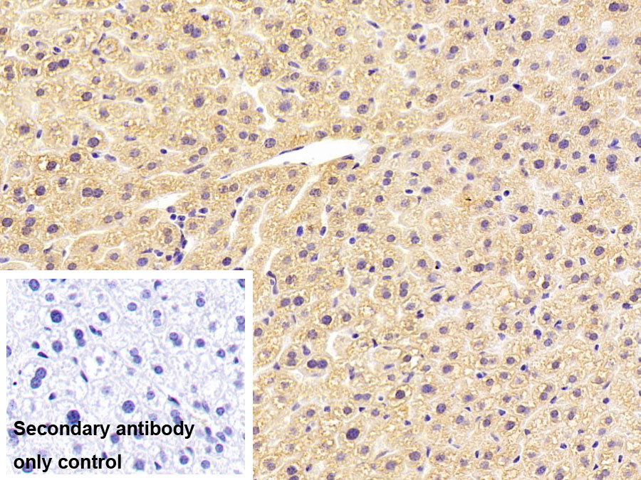 Polyclonal Antibody to Lipoprotein lipase (LPL)