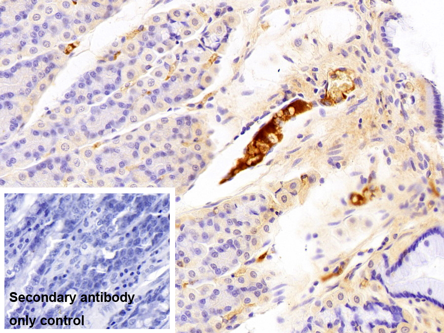 Polyclonal Antibody to Complement Component 3a (C3a)