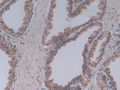 Polyclonal Antibody to Complement Component 5a (C5a)