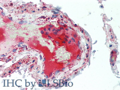 Polyclonal Antibody to Complement Component 5a (C5a)