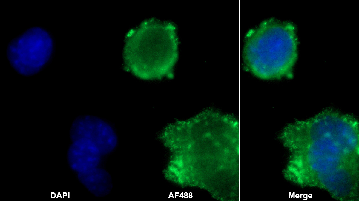Polyclonal Antibody to Protein Kinase Inhibitor Gamma (PKIg)