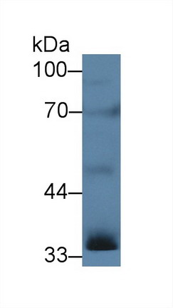 Polyclonal Antibody to Inhibin Alpha (INHa)