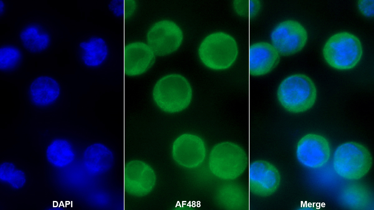 Polyclonal Antibody to Retinol Binding Protein 1, Cellular (RBP1)