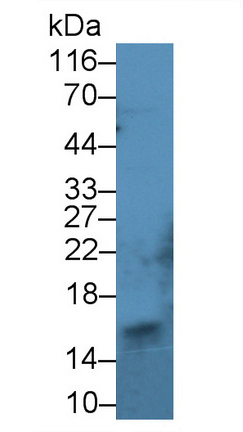 Polyclonal Antibody to Retinol Binding Protein 1, Cellular (RBP1)