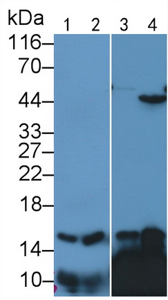 Polyclonal Antibody to Retinol Binding Protein 1, Cellular (RBP1)