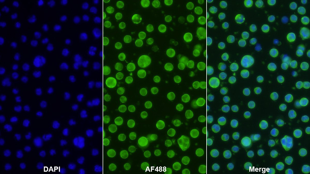 Polyclonal Antibody to Retinol Binding Protein 1, Cellular (RBP1)