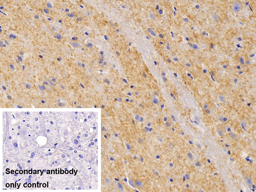 Polyclonal Antibody to Synaptophysin (SYP)