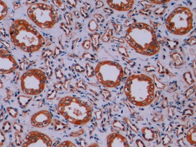 Polyclonal Antibody to Synaptophysin (SYP)