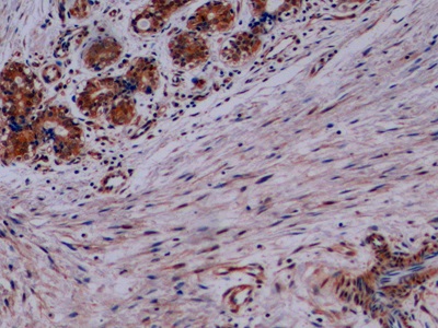 Polyclonal Antibody to Synaptophysin (SYP)
