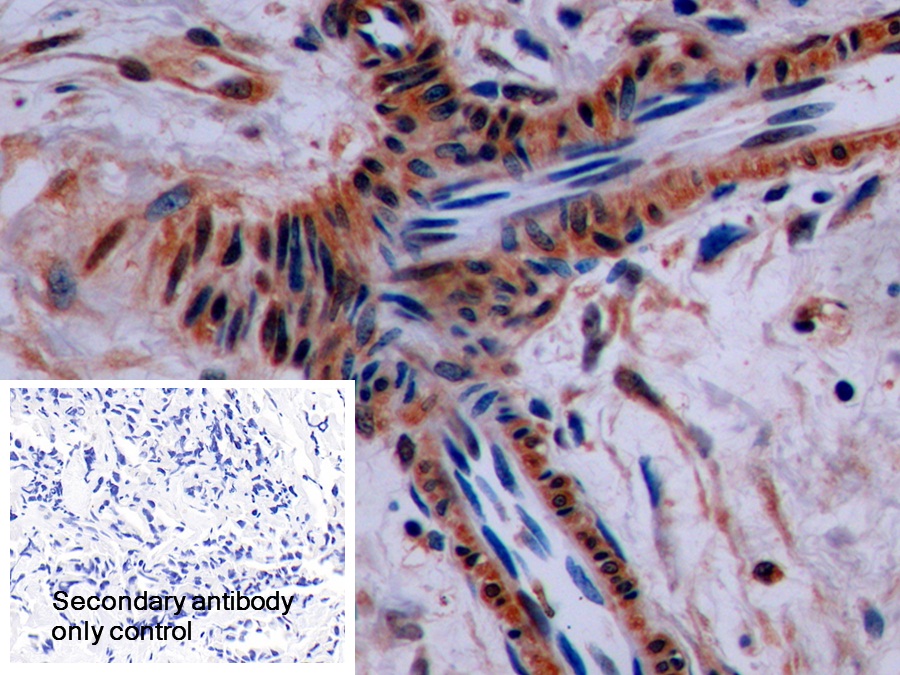 Polyclonal Antibody to Synaptophysin (SYP)