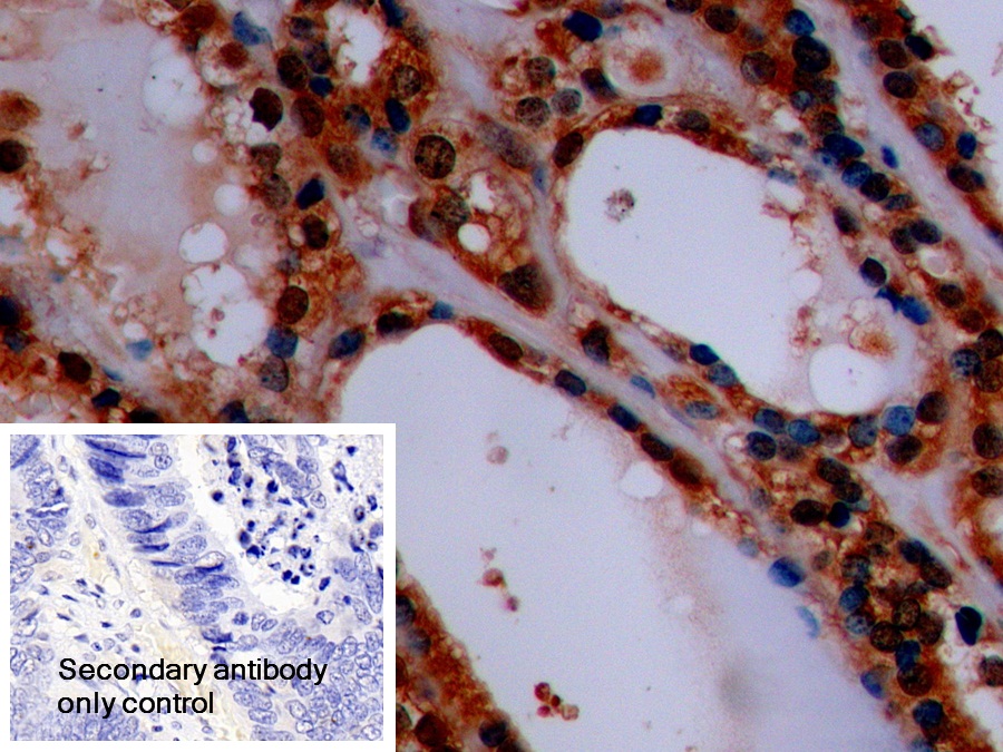 Polyclonal Antibody to Synaptophysin (SYP)