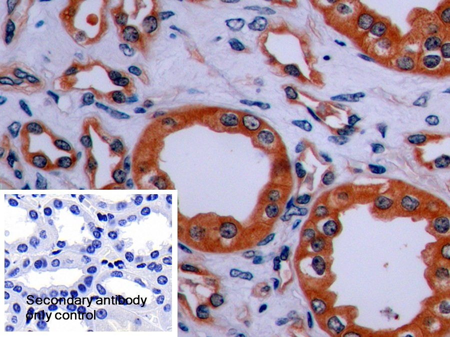 Polyclonal Antibody to Synaptophysin (SYP)