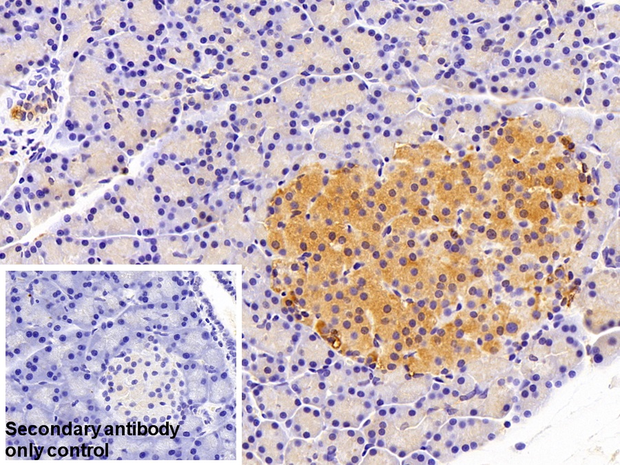 Polyclonal Antibody to Apobec 1 Complementation Factor (ACF)