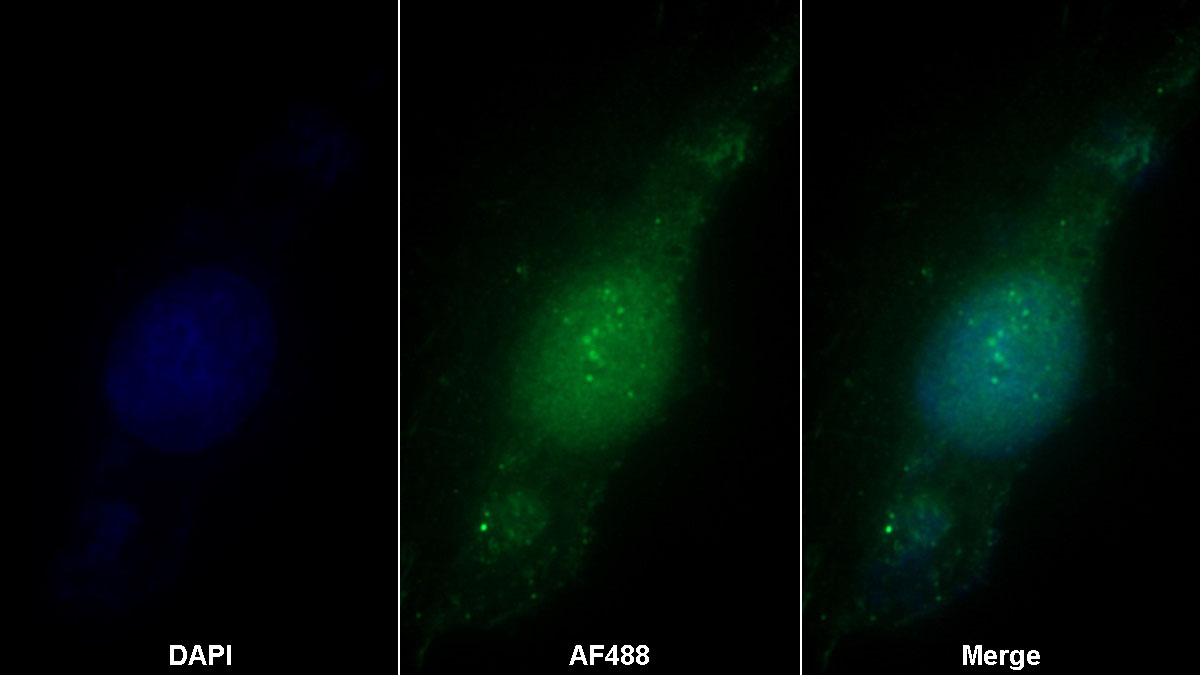 Polyclonal Antibody to Estrogen Receptor Beta (ERb)