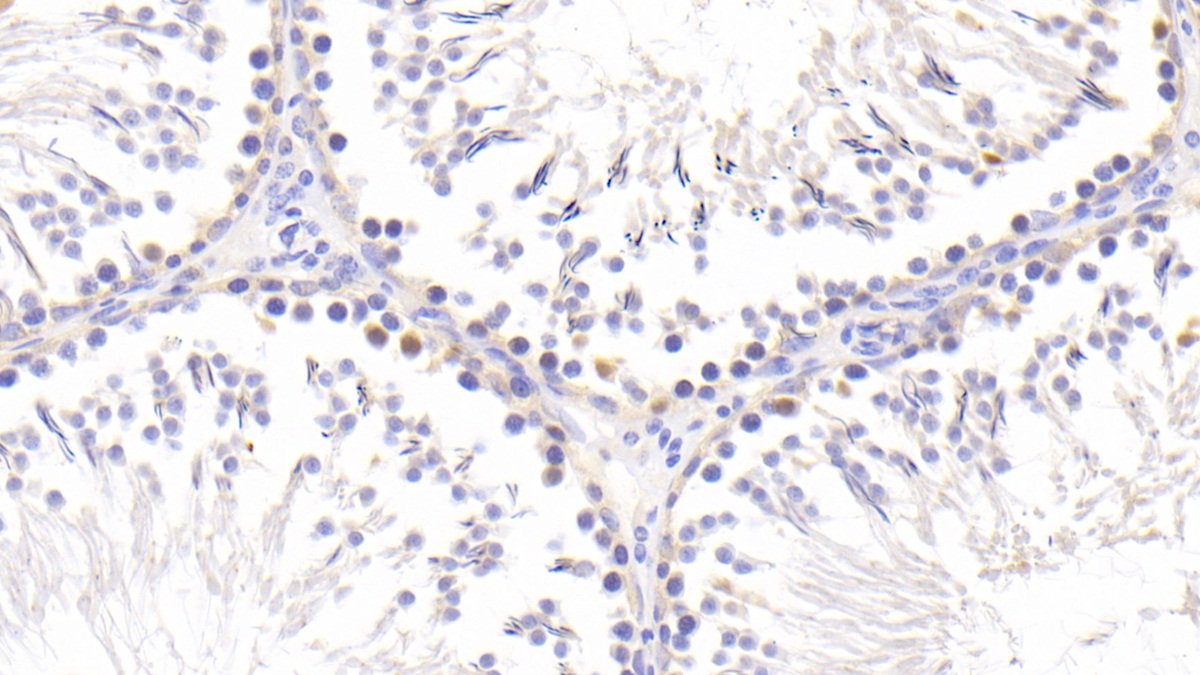 Polyclonal Antibody to Heat Shock Transcription Factor 2 (HSF2)