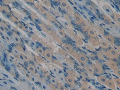 Polyclonal Antibody to Osteocalcin (OC)