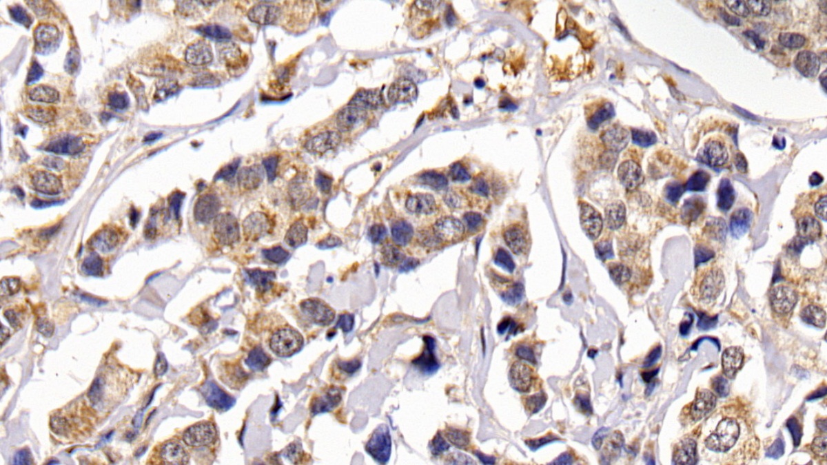 Polyclonal Antibody to Calcitonin (CT)