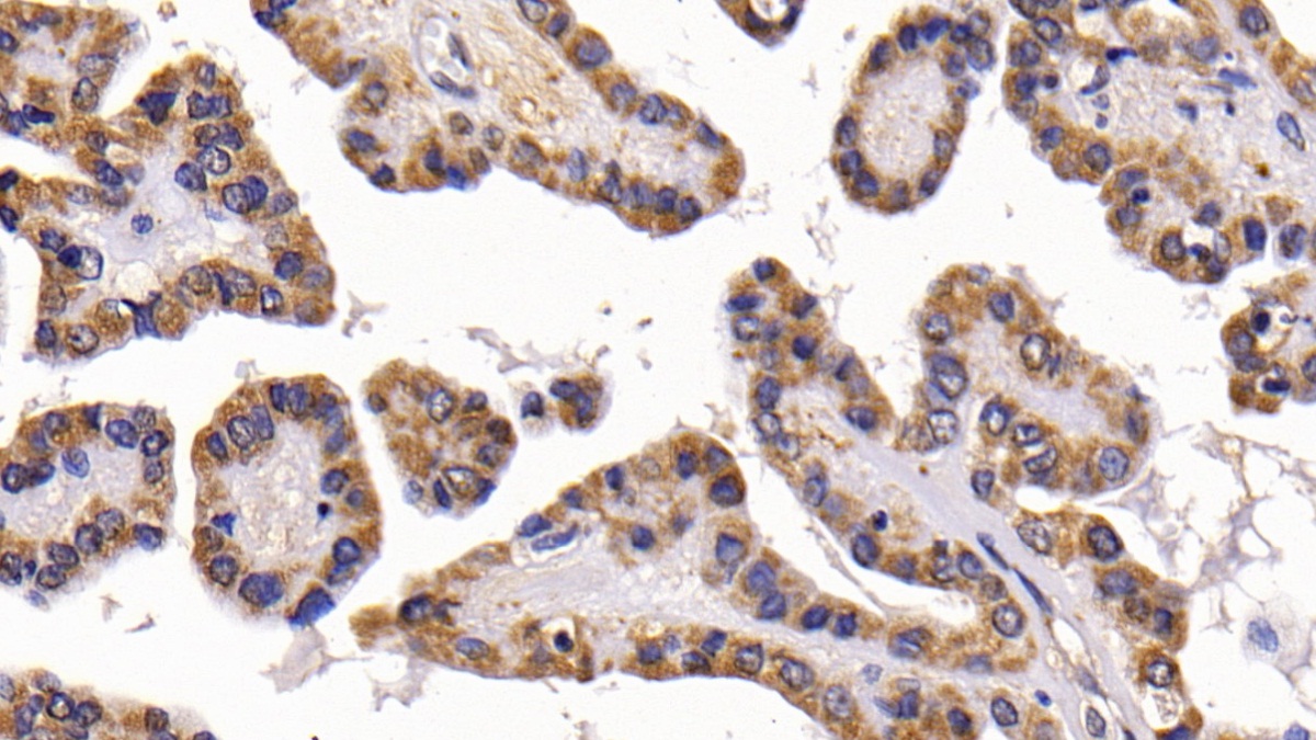 Polyclonal Antibody to Calcitonin (CT)