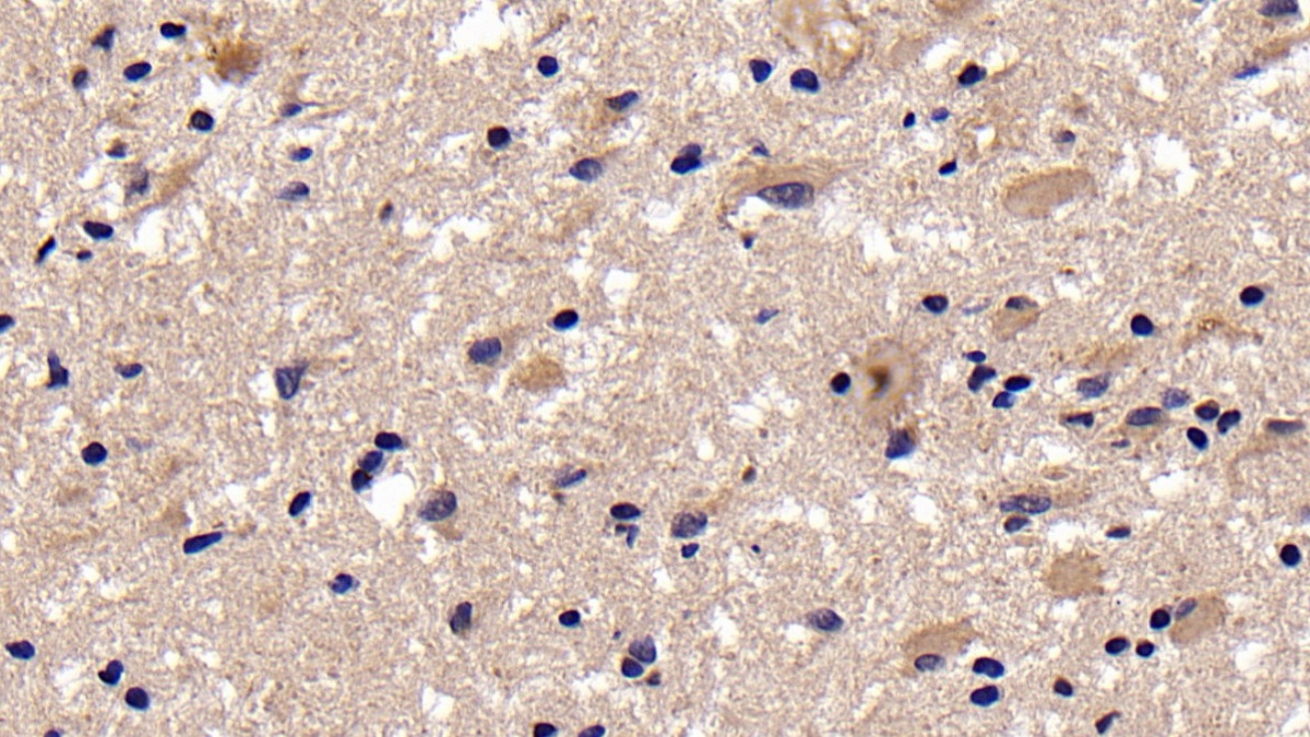 Polyclonal Antibody to Calcitonin (CT)