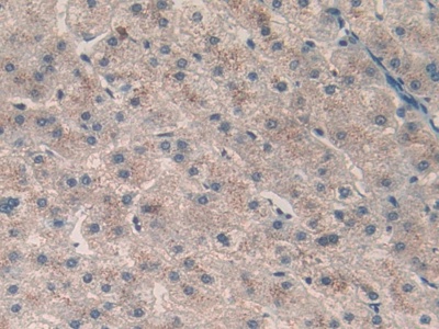 Polyclonal Antibody to Calcitonin (CT)