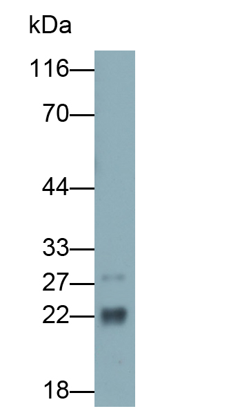 Polyclonal Antibody to Cardiac Troponin I (cTnI)