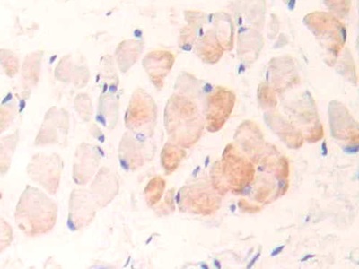 Polyclonal Antibody to Cardiac Troponin I (cTnI)