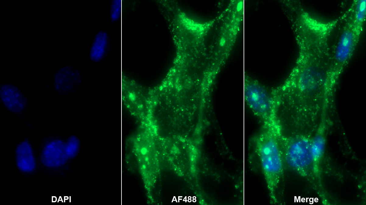 Polyclonal Antibody to Endothelin 1 (EDN1)
