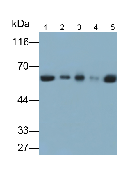 Polyclonal Antibody to Cytokeratin 5 (CK5)