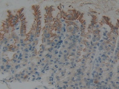Polyclonal Antibody to Cytokeratin 5 (CK5)