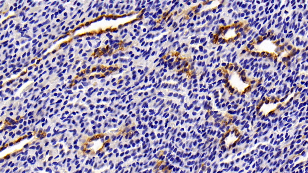 Polyclonal Antibody to Cytokeratin 4 (CK4)