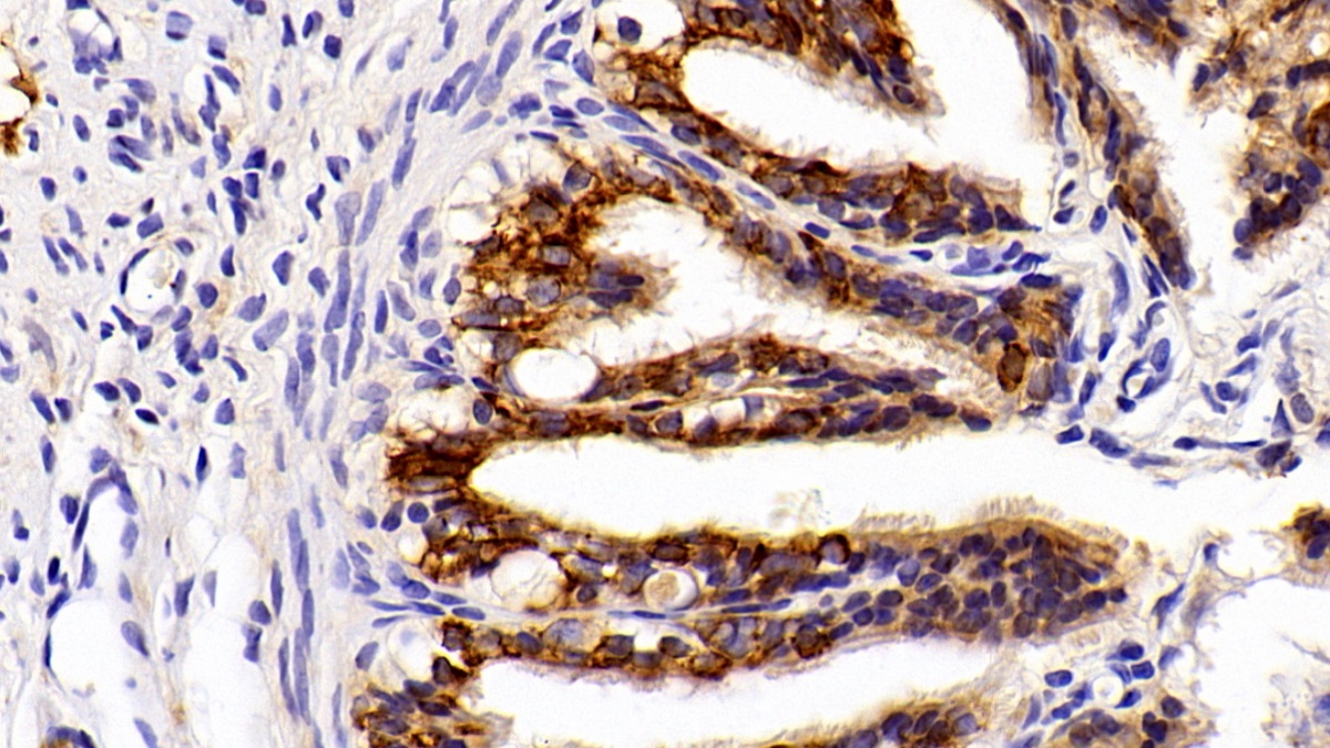 Polyclonal Antibody to Cytokeratin 4 (CK4)