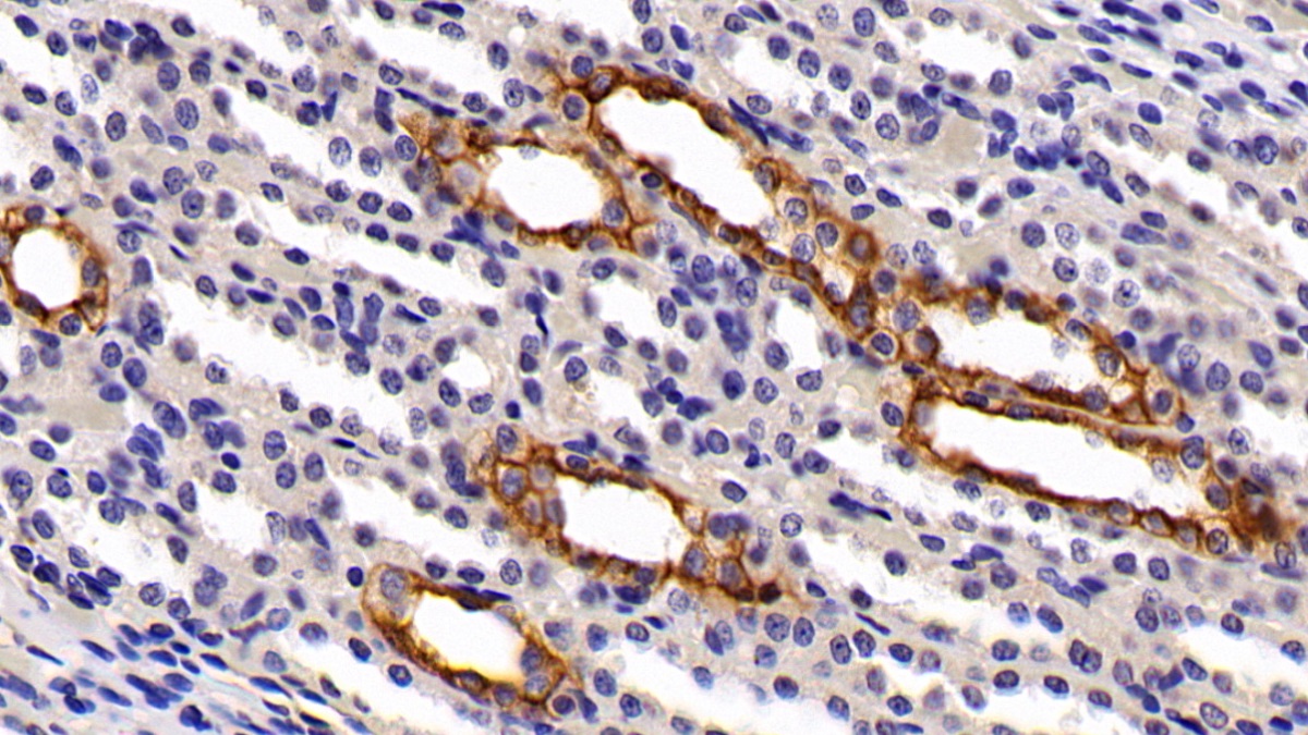 Polyclonal Antibody to Keratin 3 (KRT3)