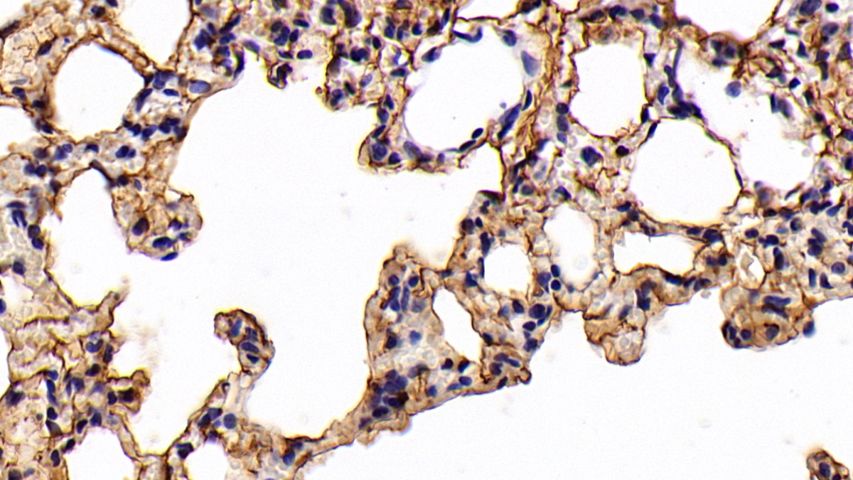 Polyclonal Antibody to Keratin 3 (KRT3)