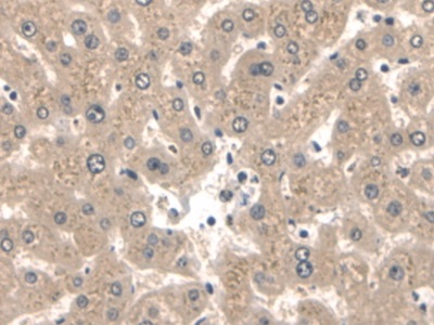 Polyclonal Antibody to Keratin 2 (CK2)