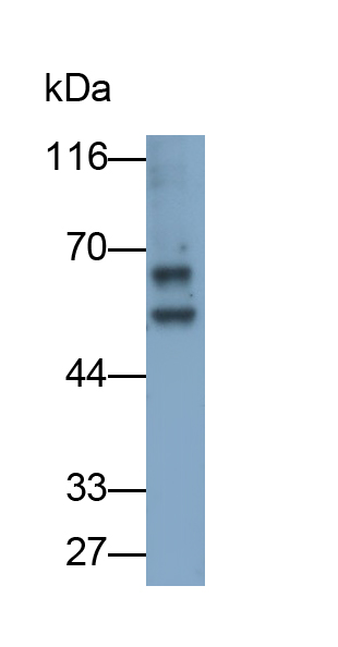 Polyclonal Antibody to Cytokeratin 1 (CK1)