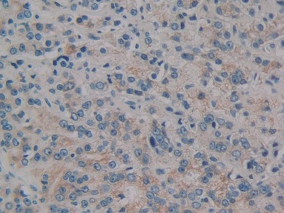 Polyclonal Antibody to Protein Kinase D1 (PKD1)