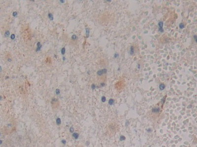 Polyclonal Antibody to Protein Kinase D1 (PKD1)