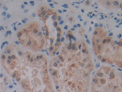 Polyclonal Antibody to Protein Kinase D1 (PKD1)