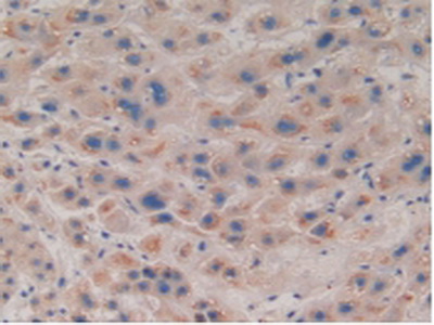 Polyclonal Antibody to Coilin (COIL)