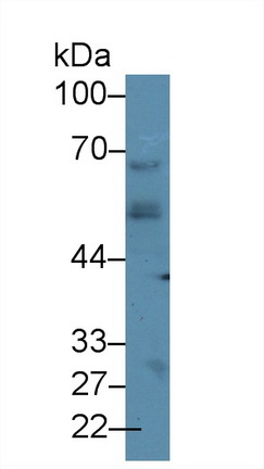 Polyclonal Antibody to Cytokeratin 15 (CK15)