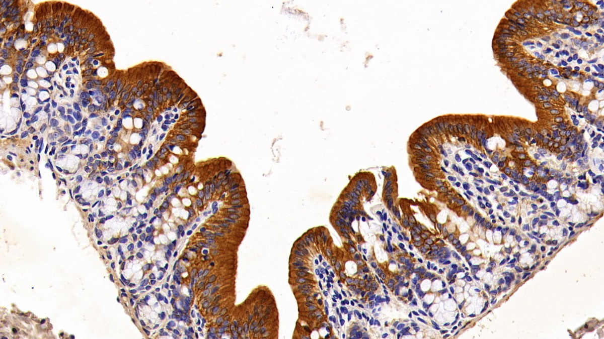 Polyclonal Antibody to Cytokeratin 15 (CK15)