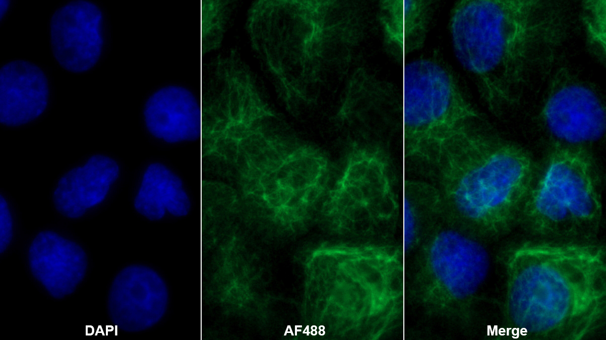Polyclonal Antibody to Cytokeratin 14 (CK14)